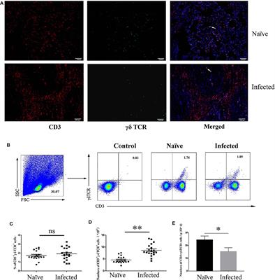 Adjustments of γδ T Cells in the Lung of Schistosoma japonicum-Infected C56BL/6 Mice